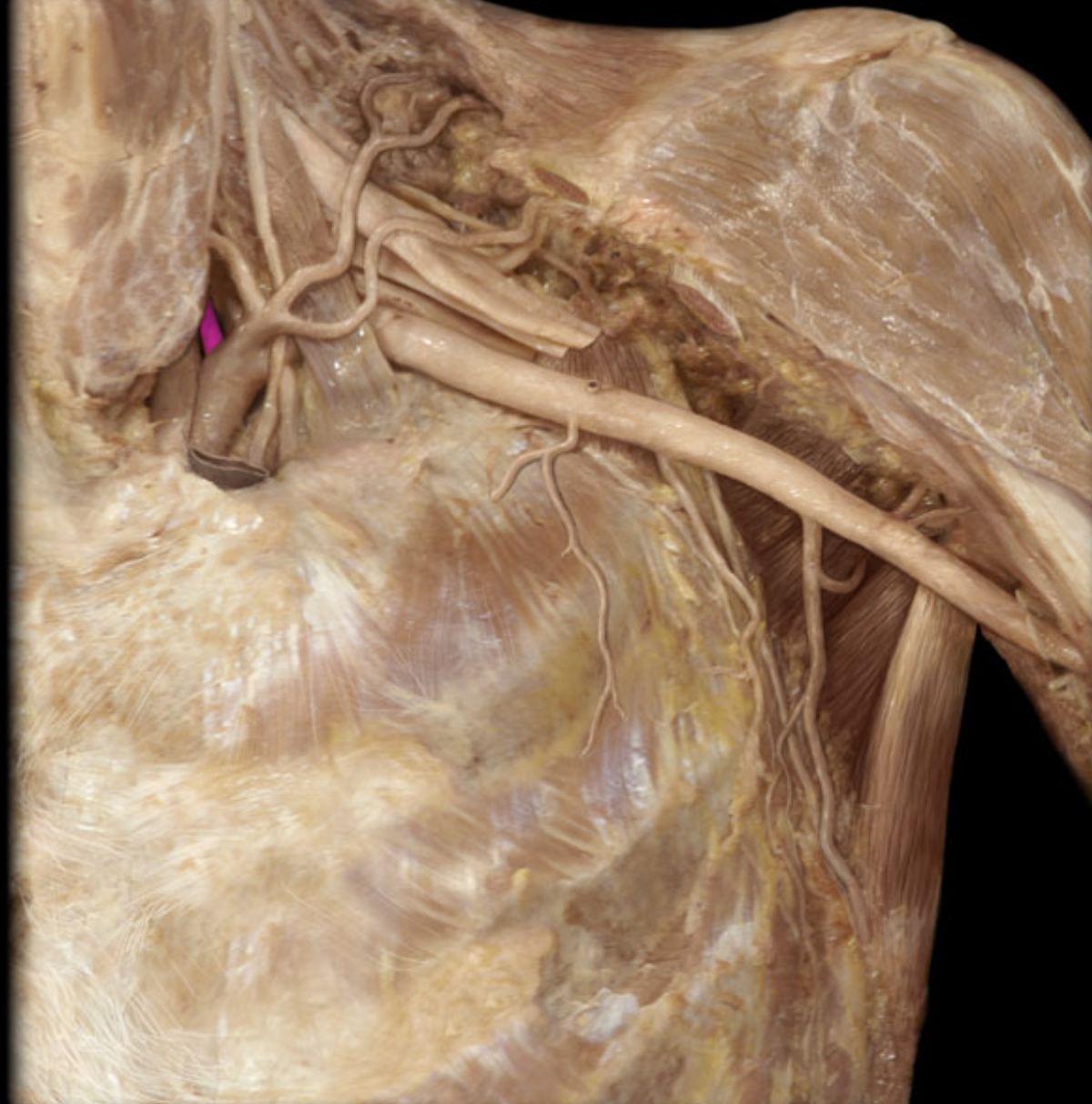 <p>legs in brain</p>