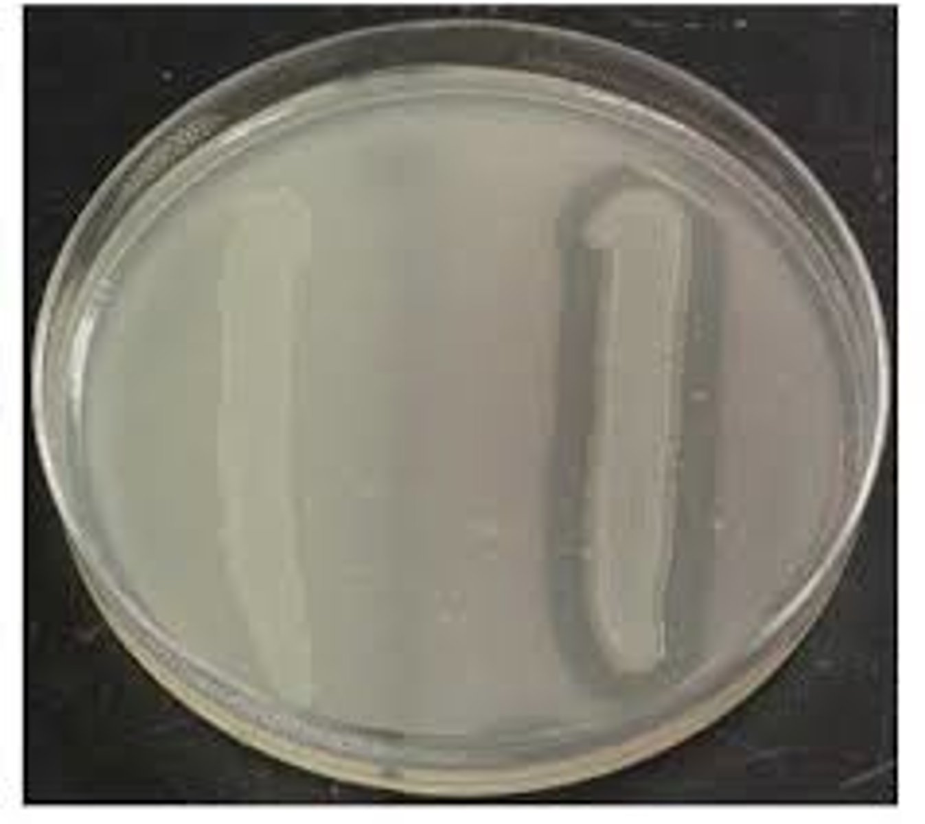 <p>What bacterial enzyme is produced by the organism on the right, distinguished by the clear area around its growth on skim milk agar?</p>
