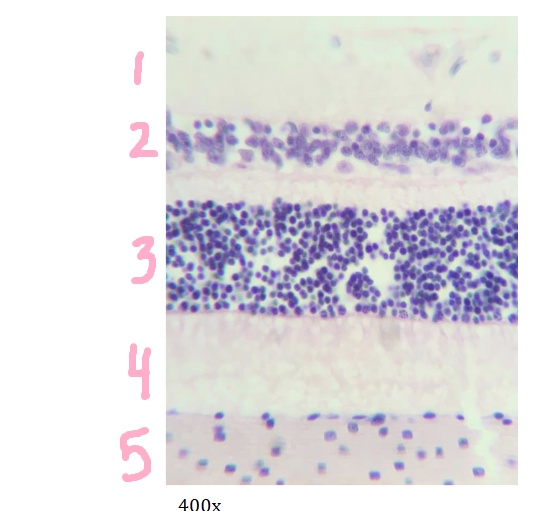 <p>What is #4 pointing to?</p>
