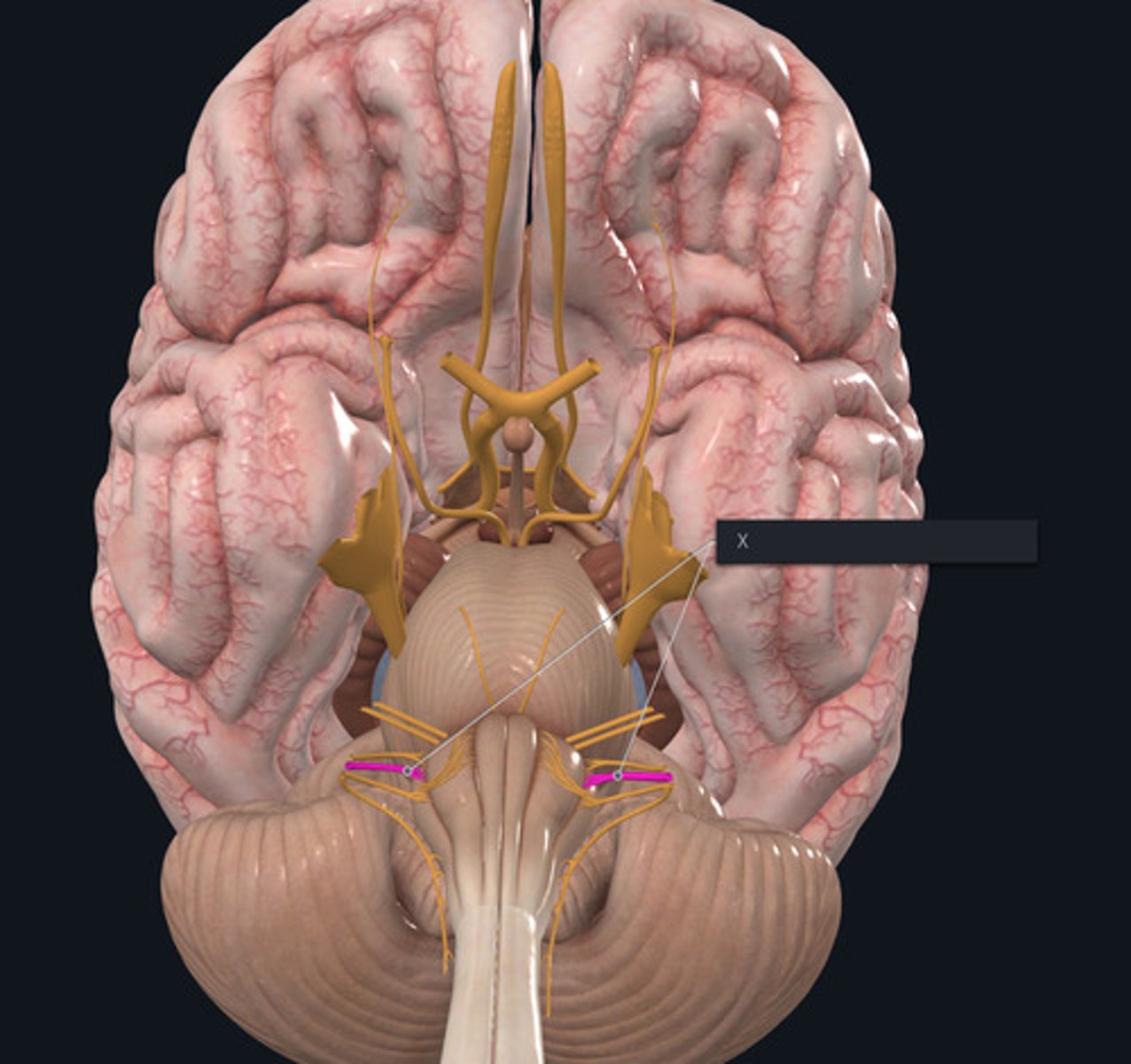 <p>Name the Nerve highlighted purple and indicated by the X.</p>