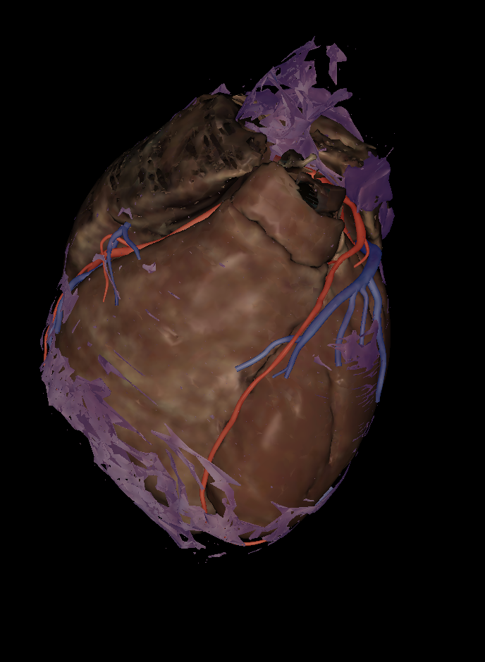 <p>Name the structure highlighted </p>