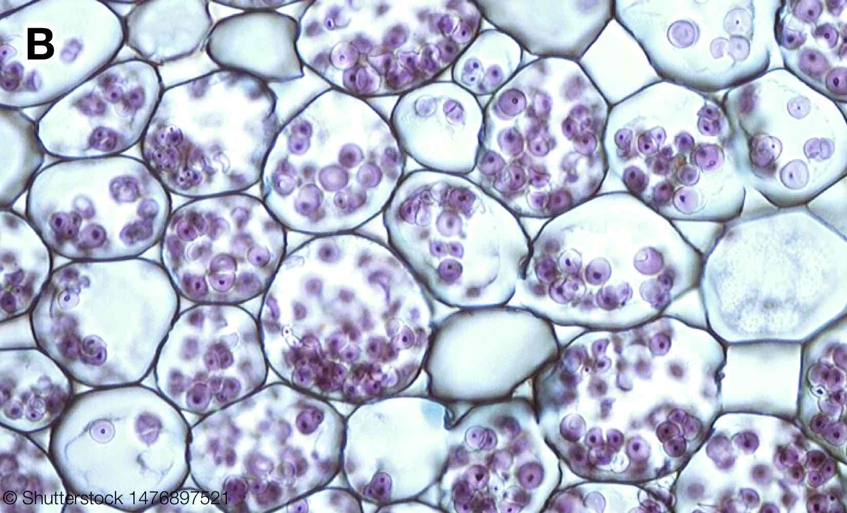 <p>Parenchyma of leaves function as storage site for starch.</p>