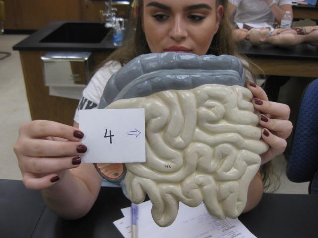 <p>Body Cavities and Body Systems</p><p>Lab Image 1-11</p>