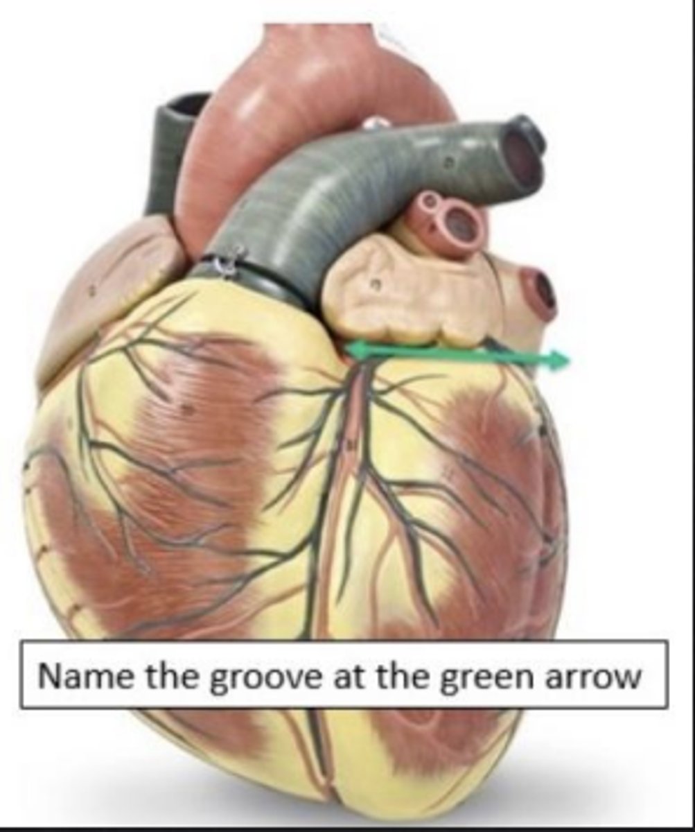 <p>What is the groove at the green arrow?</p>