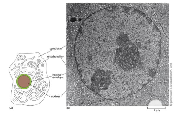 <p>Dark circle: nucleoli/nucleolus — parts of chromosomes that encode rRNA</p><p>Dark stains around the edge: <span style="color: yellow;">heterochromatin </span>(transcriptionally silent, most compact)</p><p>Light stains: <span style="color: red;">euchromatin </span>(gene rich, transcriptionally active)</p>