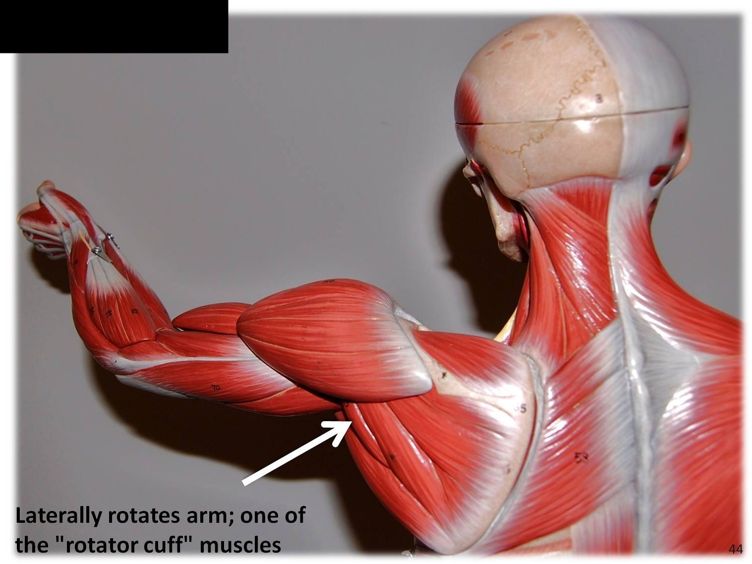 <p>What muscle is this?*****</p>