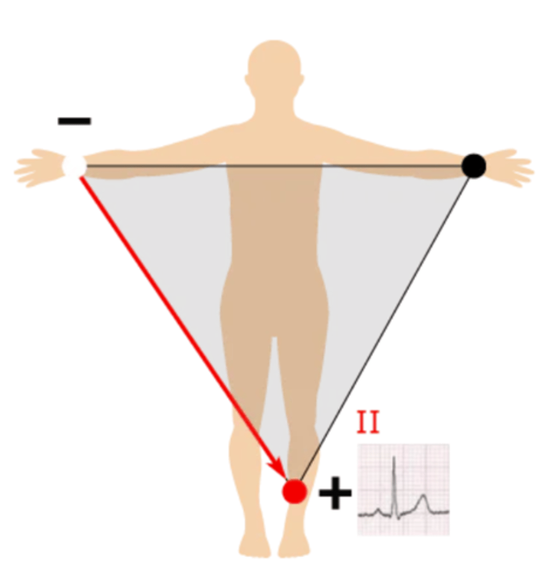 <p>Right arm --> left leg; produces a positive waveform as heart's electrical activity naturally moves down &amp; to the left</p>