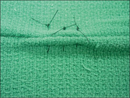 <p>name of pattern</p>