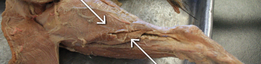 <p>posterior, right arrow </p>