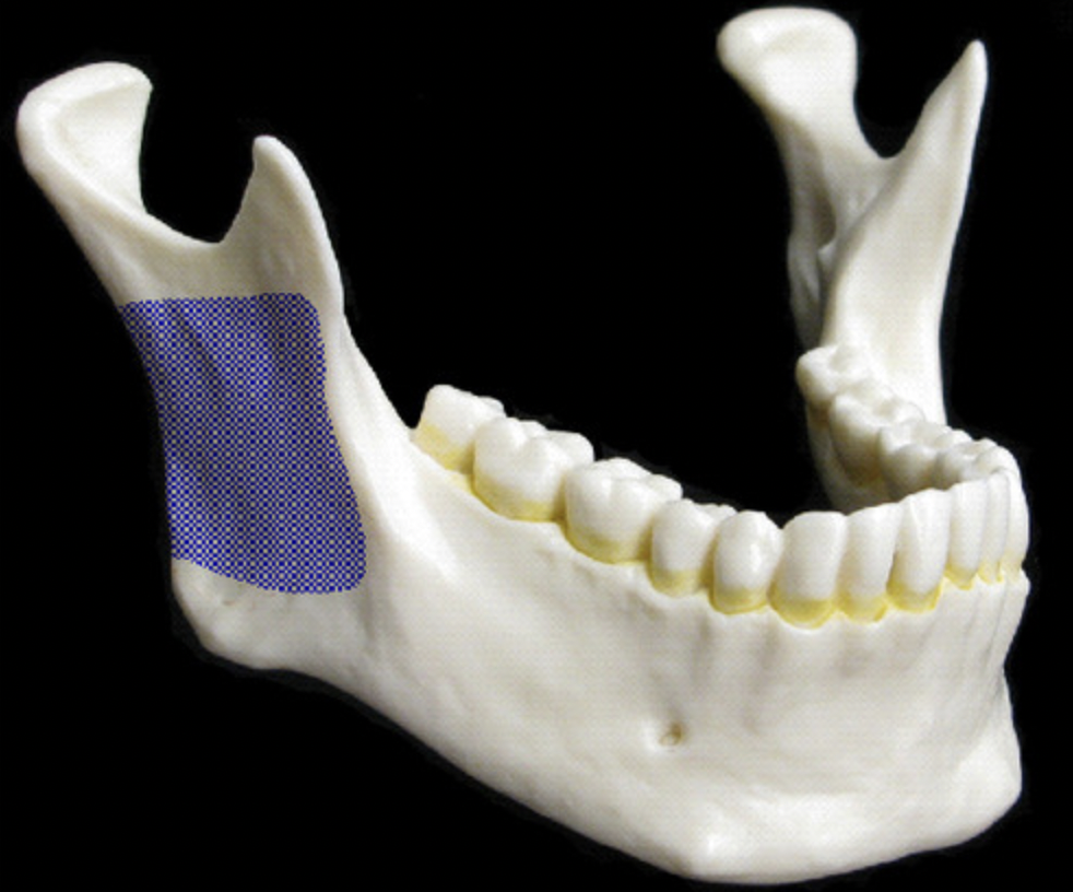 <p>posterior branches, one of either side of the body of mandible</p>