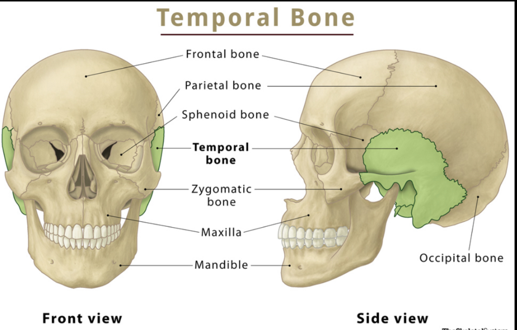 <p>Temporal bone</p>