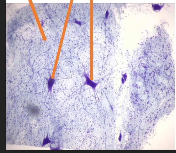 <p>what tissue is this </p>
