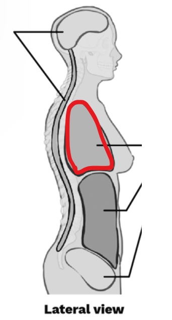 <p>What Cavity is this?</p>
