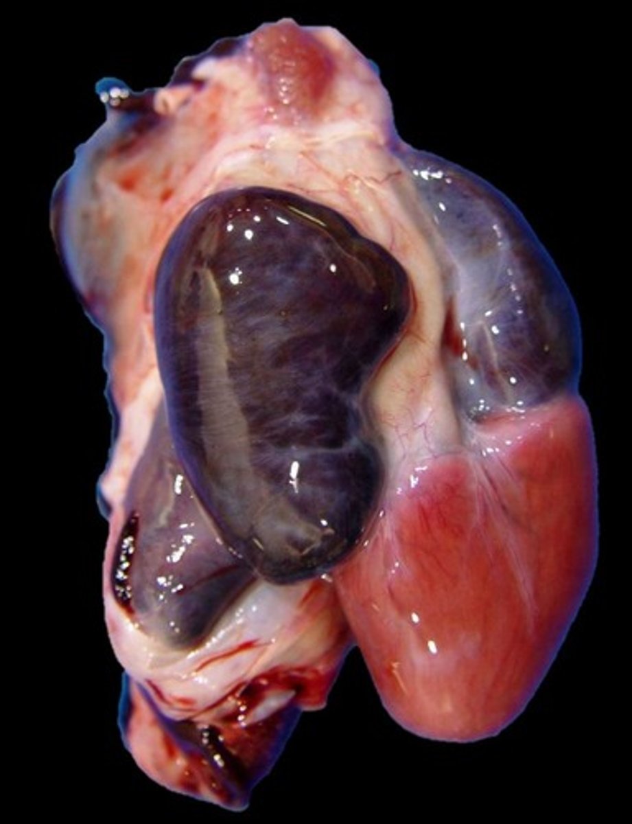 <p>Right atrium (RA), left atrium (LA), right ventricle (RV), and left ventricle (LV).</p>