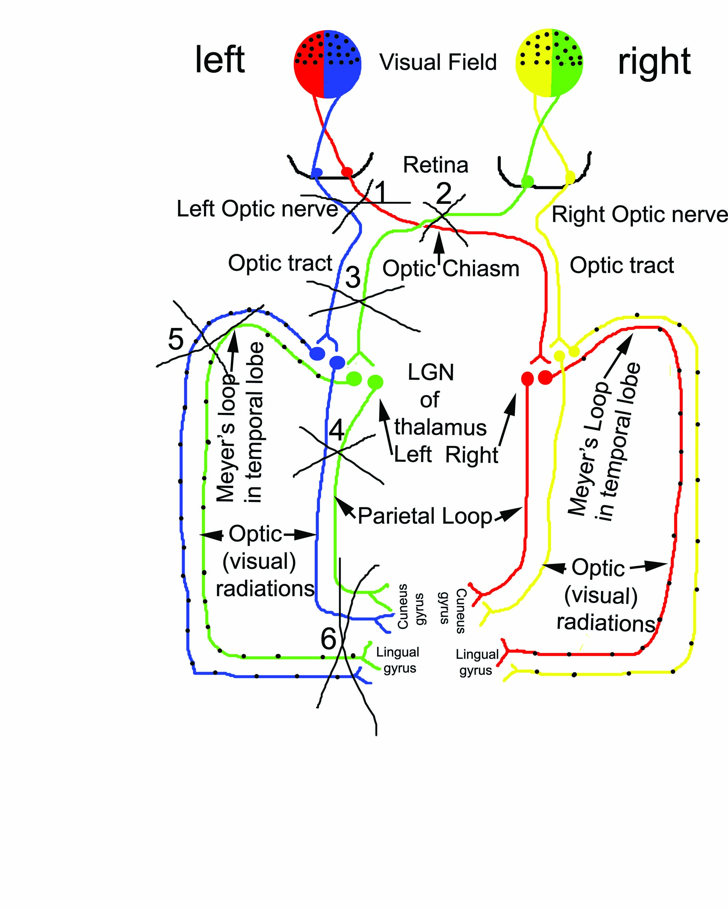<p>What area (1-6) when lesioned will cause contralateral homonymous superior quadrantopsia </p>