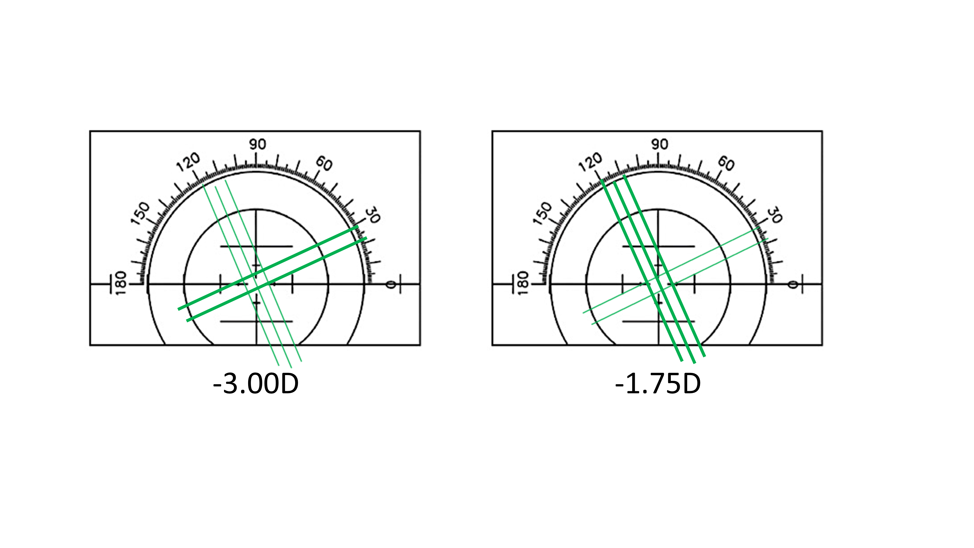 <p><span>What is the sphero-cylindrical combination in </span><strong>plus-cylinder writing </strong><span>for these two positions of clear lines in the manual focimeter?&nbsp;</span></p>