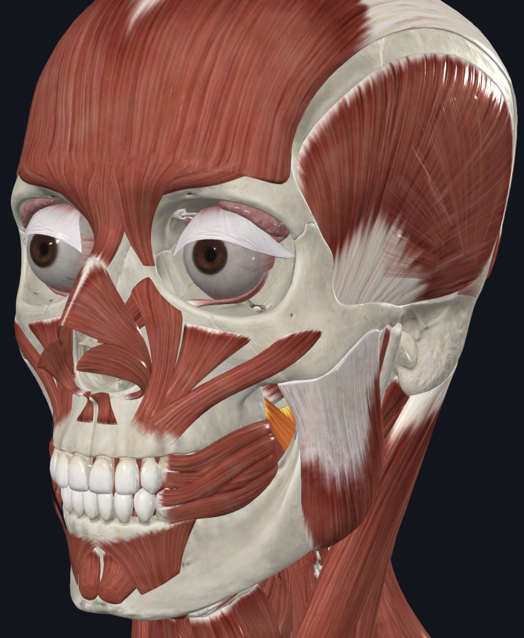 term image