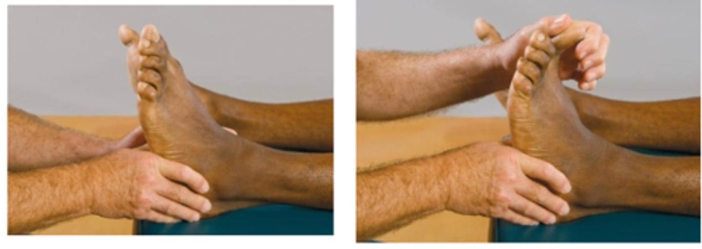 <p>Assessment for:</p><p>- Sciatic radiculopathy</p>