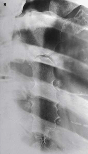 <p>What projection, position and anatomy is this?</p>