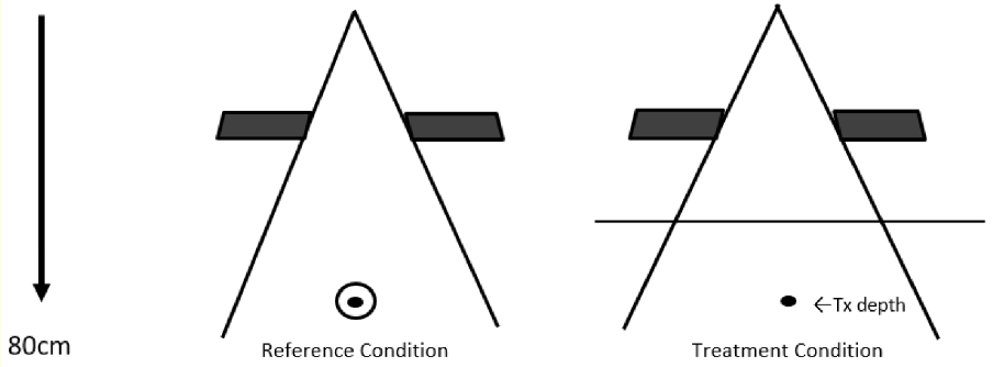 <p>the ratio of absorbed dose at depth in a tissue to the absorbed dose at the same point in air within a build-up cap</p>