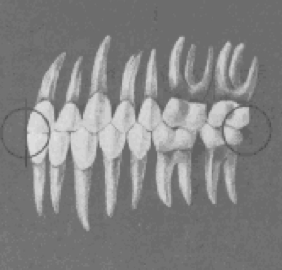 <p>best when the plane of occlusion is relatively flat</p>