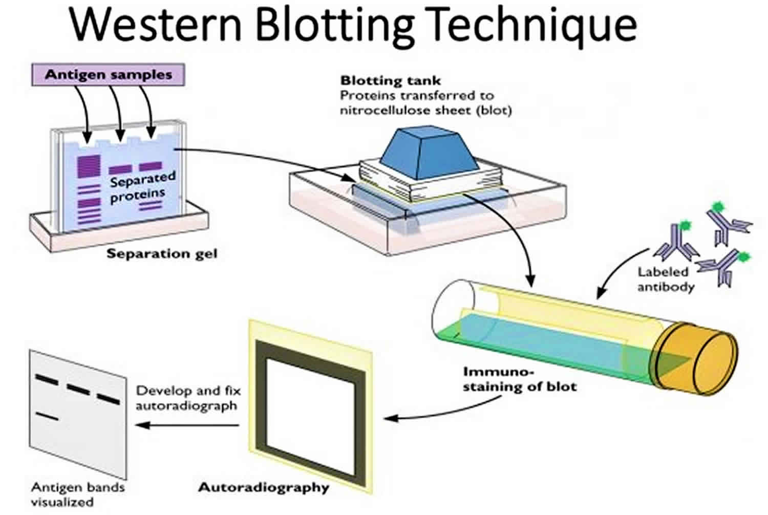 western blotting technique