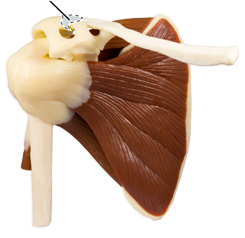 <p>What ligament is highlighted here?</p>