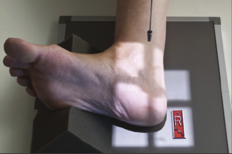 <p>Fine FS, 100cm</p><p>62kVp, 4mAs</p><p>Straight tube</p><p>CR: 2.5cm inferior/posterior to medial malleolus</p>