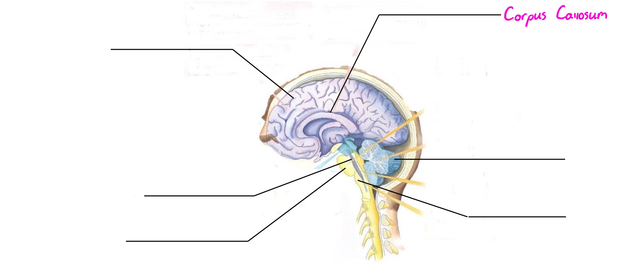<p>Part of forebrain; thick band of axons connecting 2 hemispheres of cerebral cortex</p>