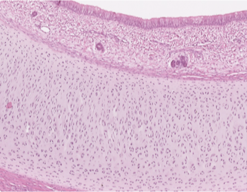 <p>Which cartilage is shown in the following image?</p>