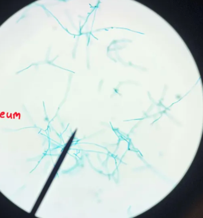 <p>Which division do Protonema belong to?</p>