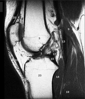 <p><span>quadriceps femoris muscle?</span></p>