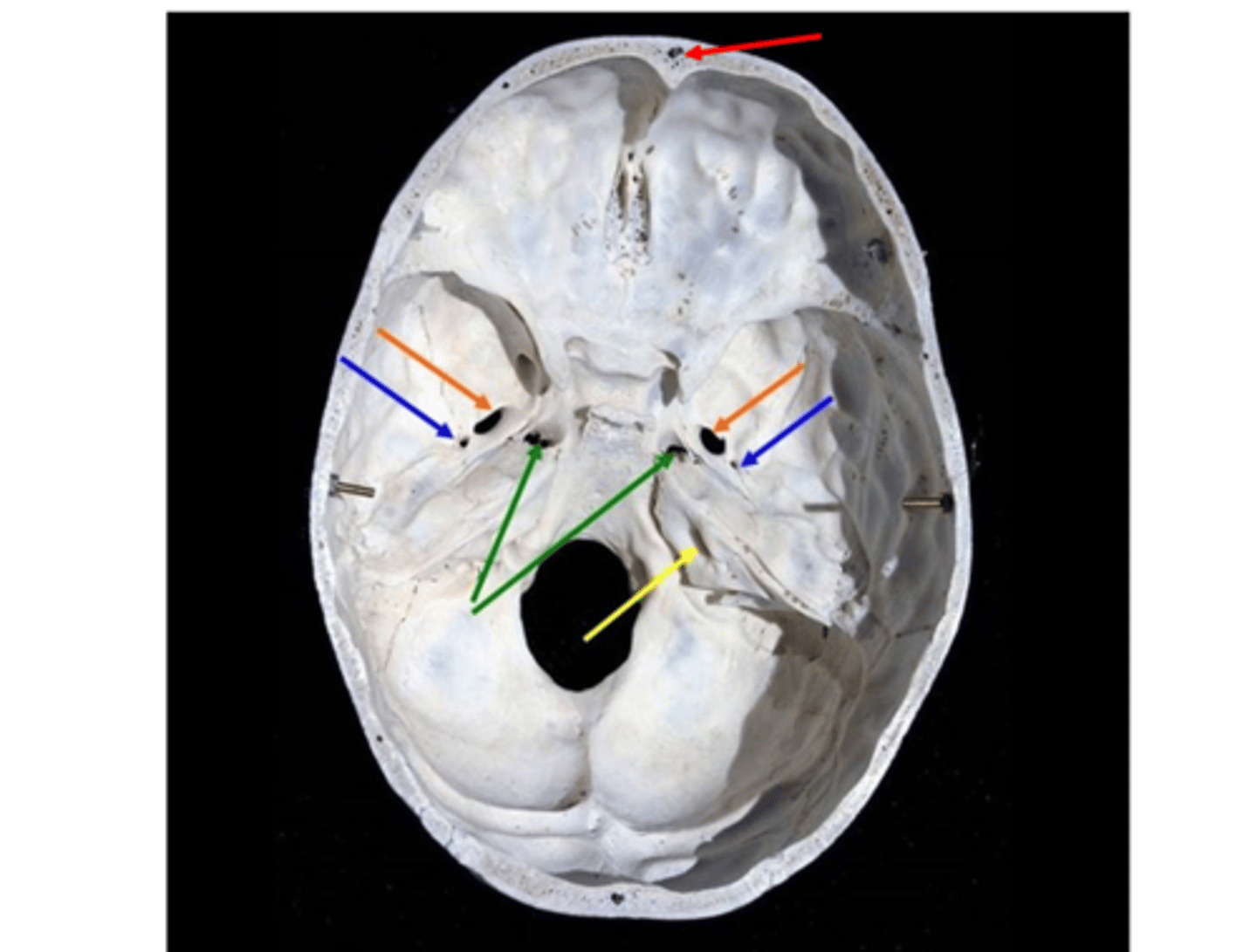 <p>What is the RED arrow pointing to?</p>