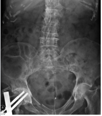 <p>What is this and what type of scan </p>