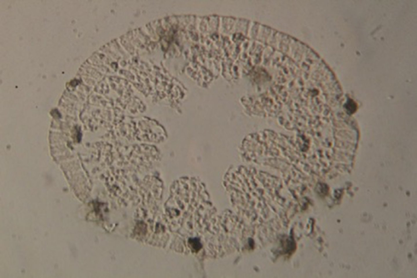 <p>Phylum: Cnidaria</p><p>Class: Hydrozoa</p><p>Genus: Hydra</p><p>Hydra c.s. (cross-section)</p>