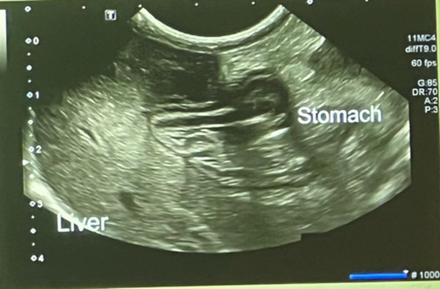 <p>what part of the liver is this showing?</p>