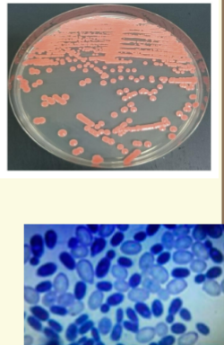 <p><span style="color: #f8f8f8"> Rare fungemia in</span><span style="color: #f8f8f8"><br></span><span style="color: #f8f8f8">immunocompromised</span><span style="color: #f8f8f8"><br></span><span style="color: #f8f8f8">patients</span><span style="color: #f8f8f8"><br></span><span style="color: #f8f8f8">4 Macroscopic morphology:</span><span style="color: #f8f8f8"><br></span><span style="color: #f8f8f8">Pink to coral colored</span><span style="color: #f8f8f8"><br></span><span style="color: #f8f8f8">colonies with wet, soft</span><span style="color: #f8f8f8"><br></span><span style="color: #f8f8f8">appearance</span><span style="color: #f8f8f8"><br></span><span style="color: #f8f8f8">4 Microscopic morphology:</span><span style="color: #f8f8f8"><br></span><span style="color: #f8f8f8">Budding cells are round to</span><span style="color: #f8f8f8"><br></span><span style="color: #f8f8f8">oval, occasional rudimentary</span><span style="color: #f8f8f8"><br></span><span style="color: #f8f8f8">pseudohyphae</span></p>