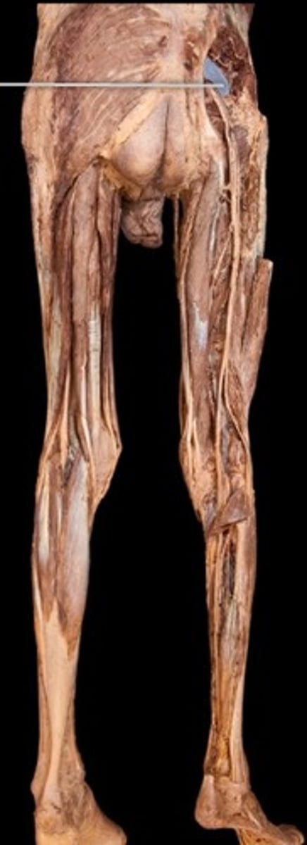 <p>What muscle is this?</p>