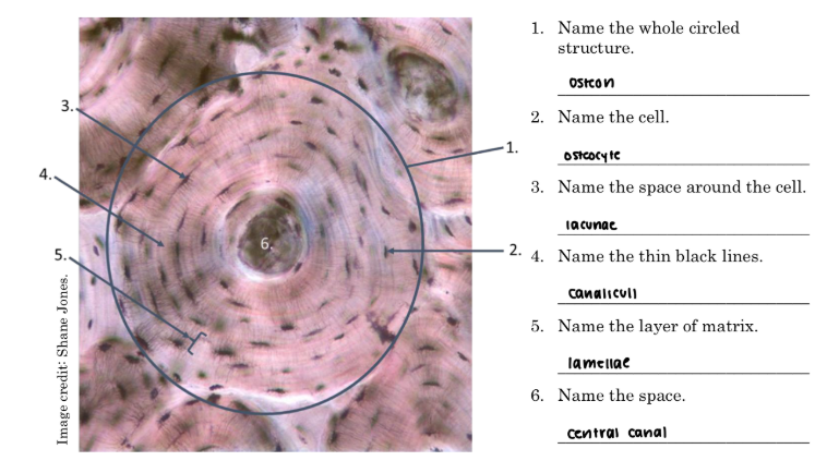 <p><strong>SMALL CANALS WITHIN LAYERS OF BONE MATRIX</strong></p><ul><li><p>it connects osteocytes together, which ENCOURAGES EXCHANGES between the osteocytes</p></li></ul><p></p>