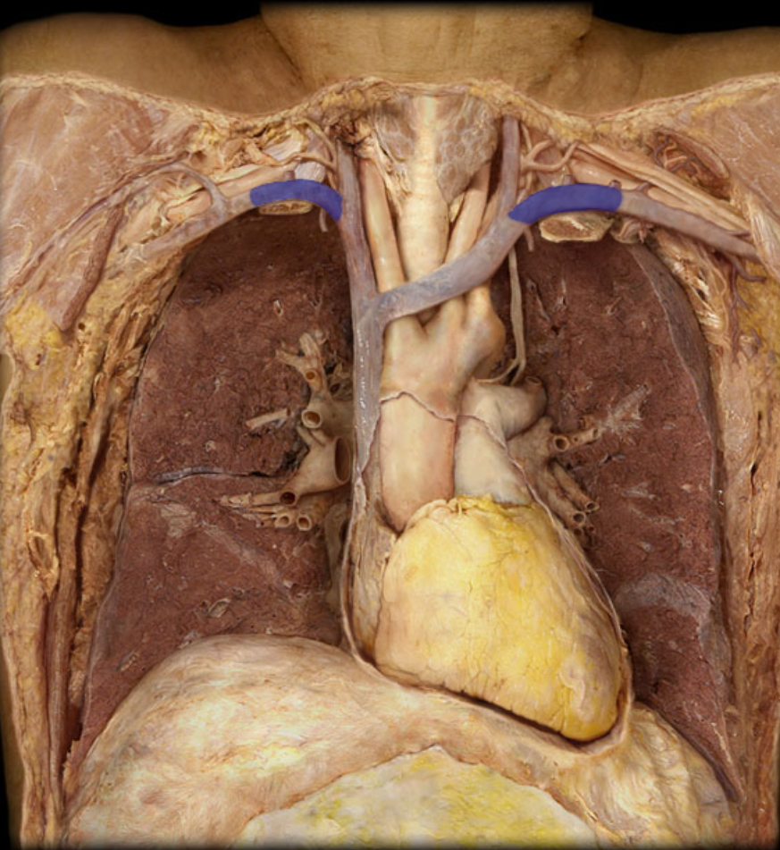 <p>Identify the structure</p>