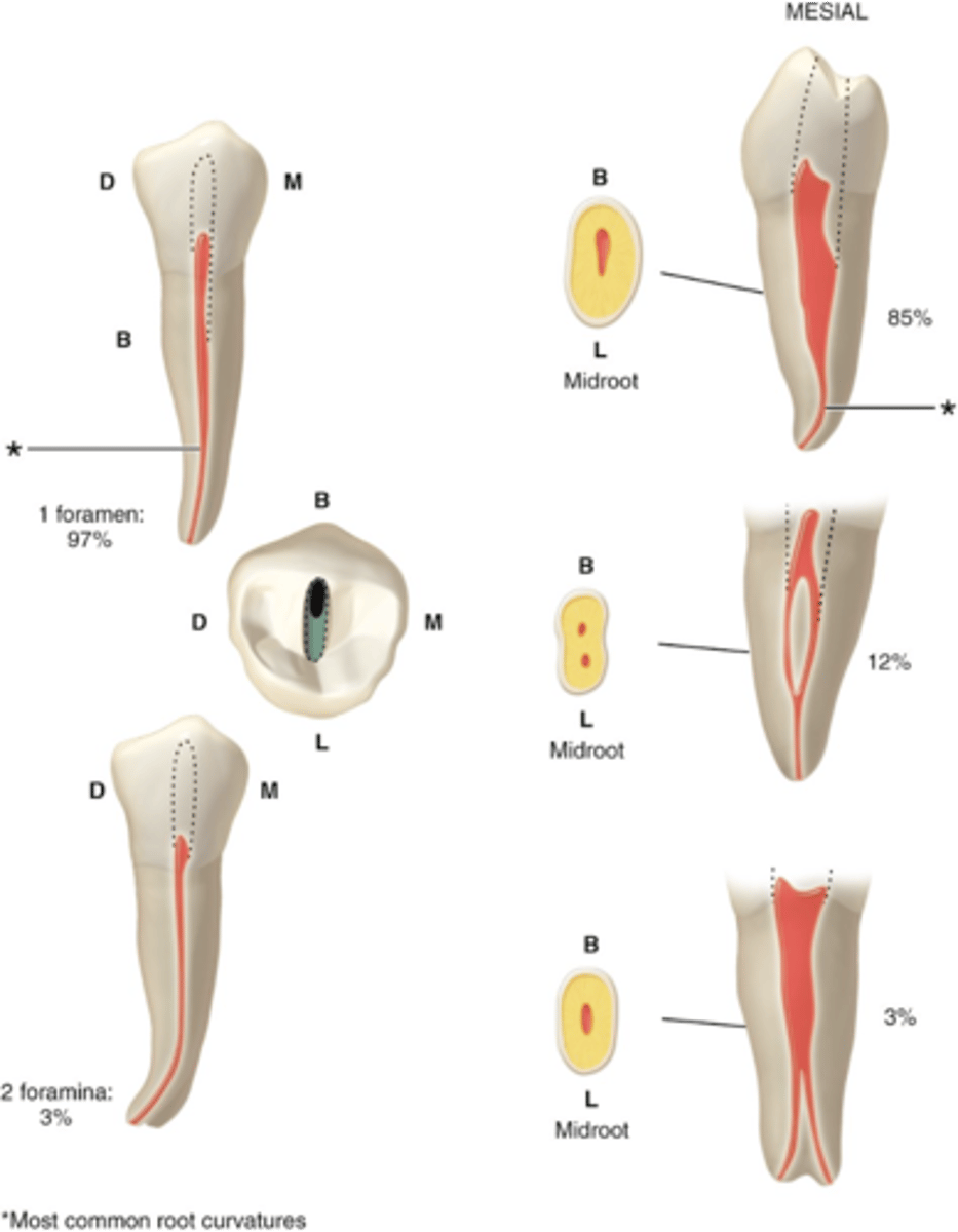 <p>mandibular second premolar access shape</p>