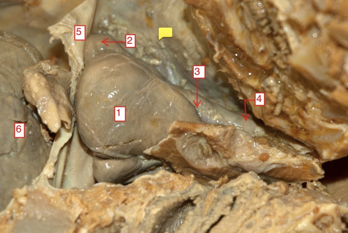 <p>female spiny dogfish- (6)</p>