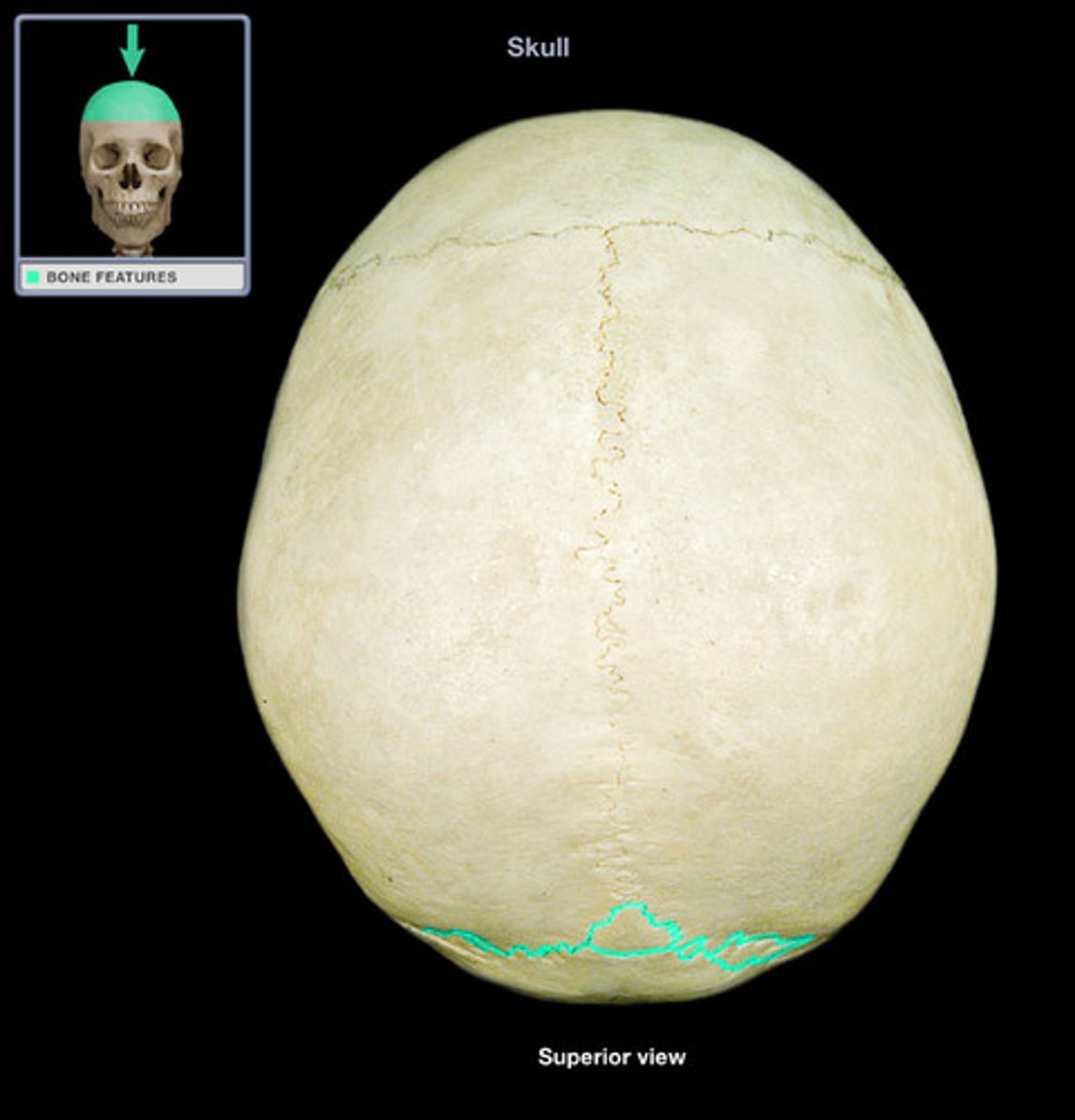 <p>(name the suture)</p>