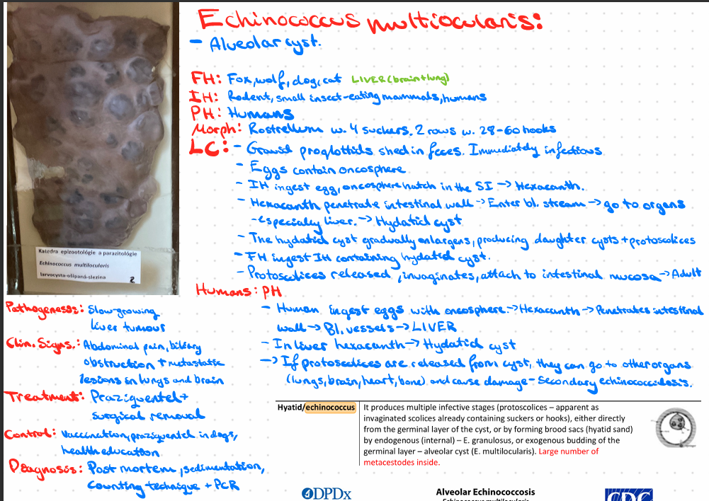 <p>Echinococcus multilocularis - Alveolar cyst</p>