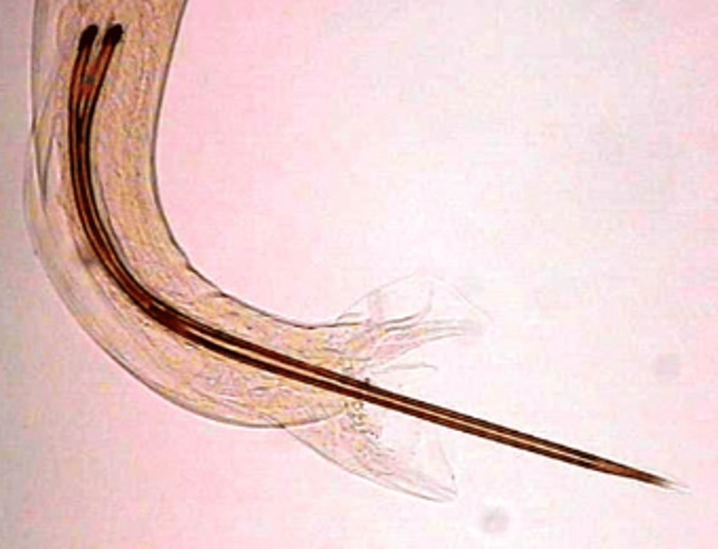 <p>which nematode of the order Strongylida is this?</p>