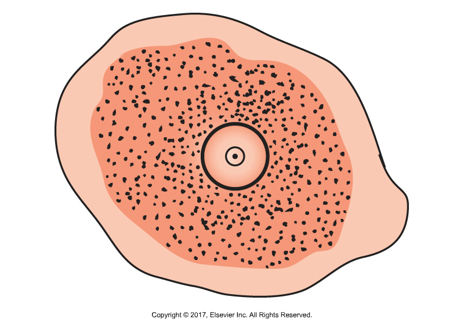 <p>Amorphous (blob-like shape)</p>
