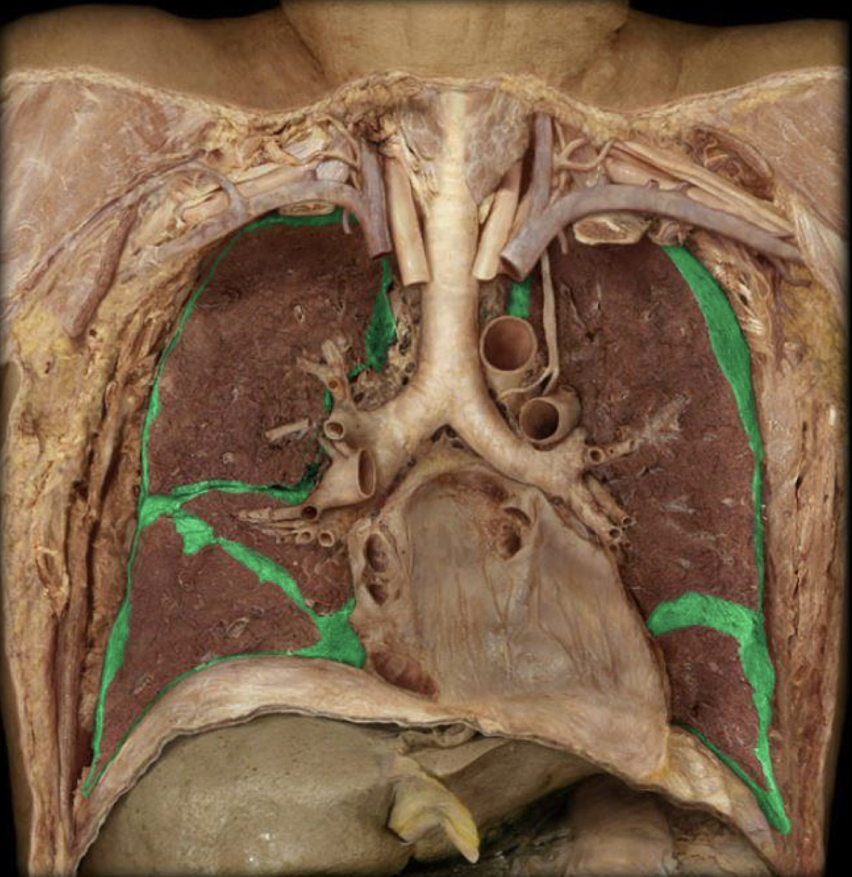 What structure is highlighted in green?