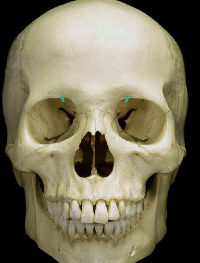 <p>what part of the skull is highlighted</p>