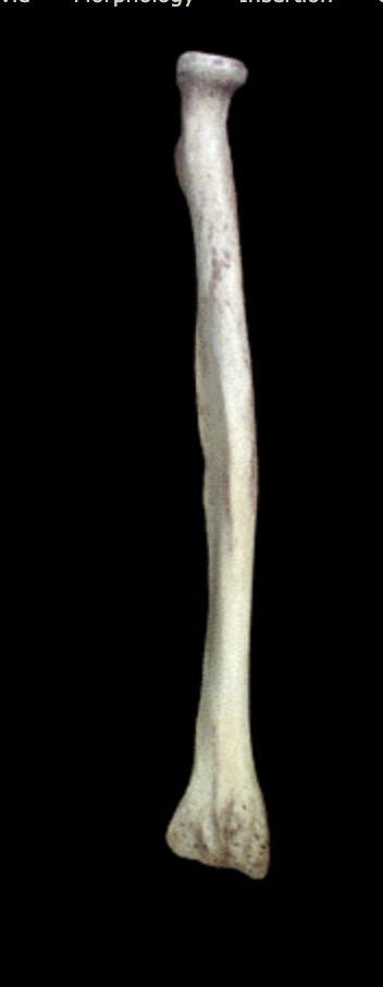 <p>What view is this? Anterior or posterior?</p>