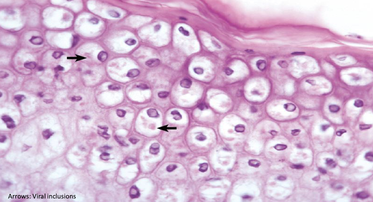 <p>What is this an example of? What are the arrows pointing to?</p>